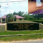 Mapolsek Poasia dan luka dikaki korban. Foto: Ist